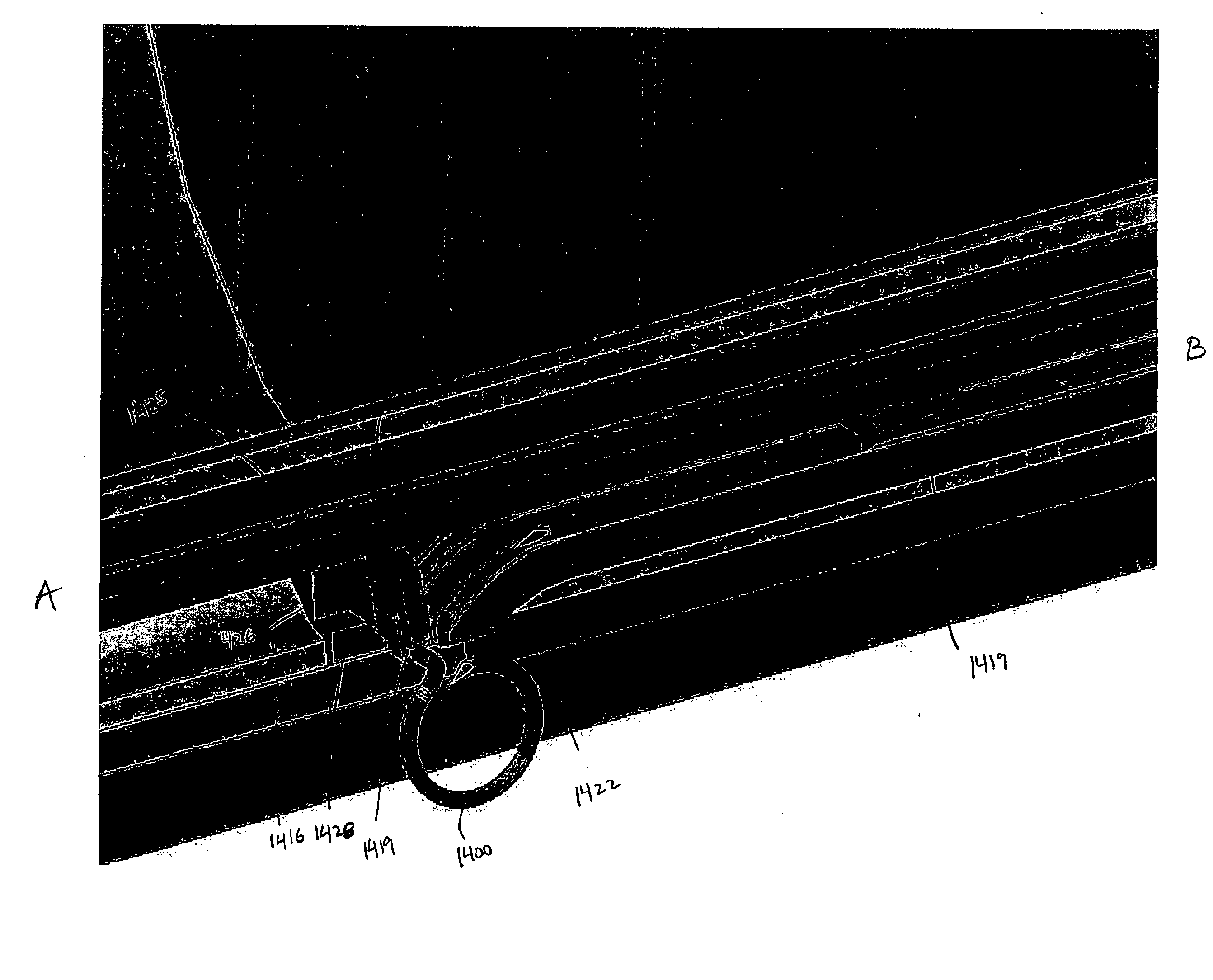 Endovascular stapler