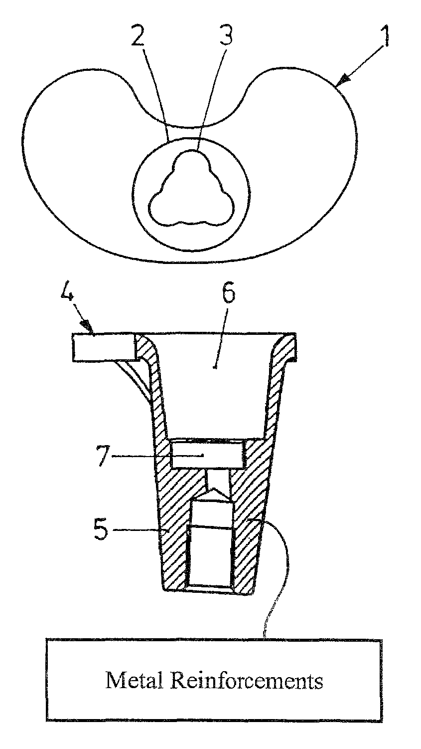 Tibia component and sliding plate of a knee-joint endoprosthesis