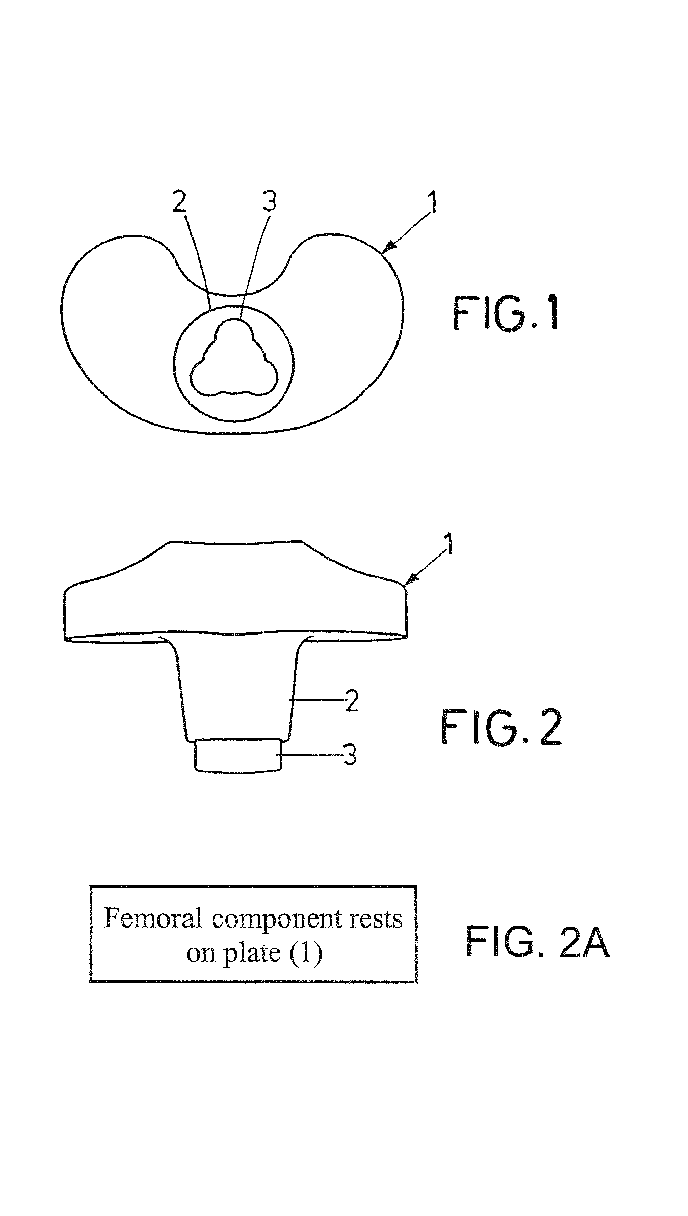 Tibia component and sliding plate of a knee-joint endoprosthesis