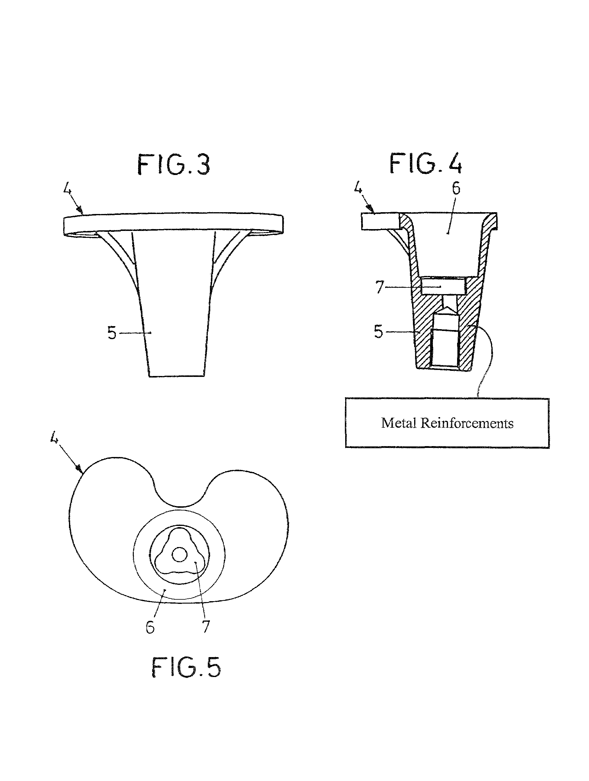 Tibia component and sliding plate of a knee-joint endoprosthesis