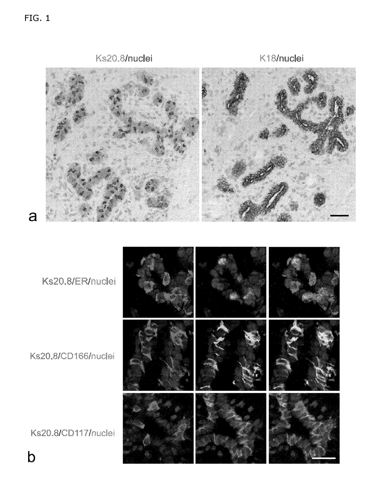 Isolation and long-term culturing of estrogen receptor-positive human breast epithelial cells