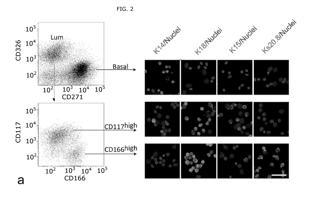 Isolation and long-term culturing of estrogen receptor-positive human breast epithelial cells