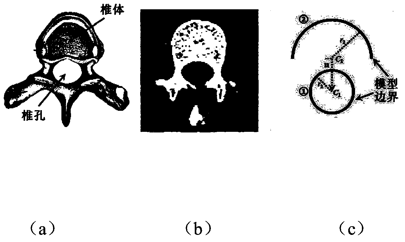 Method for extracting spinal marrow in CT (Computed Tomography) image