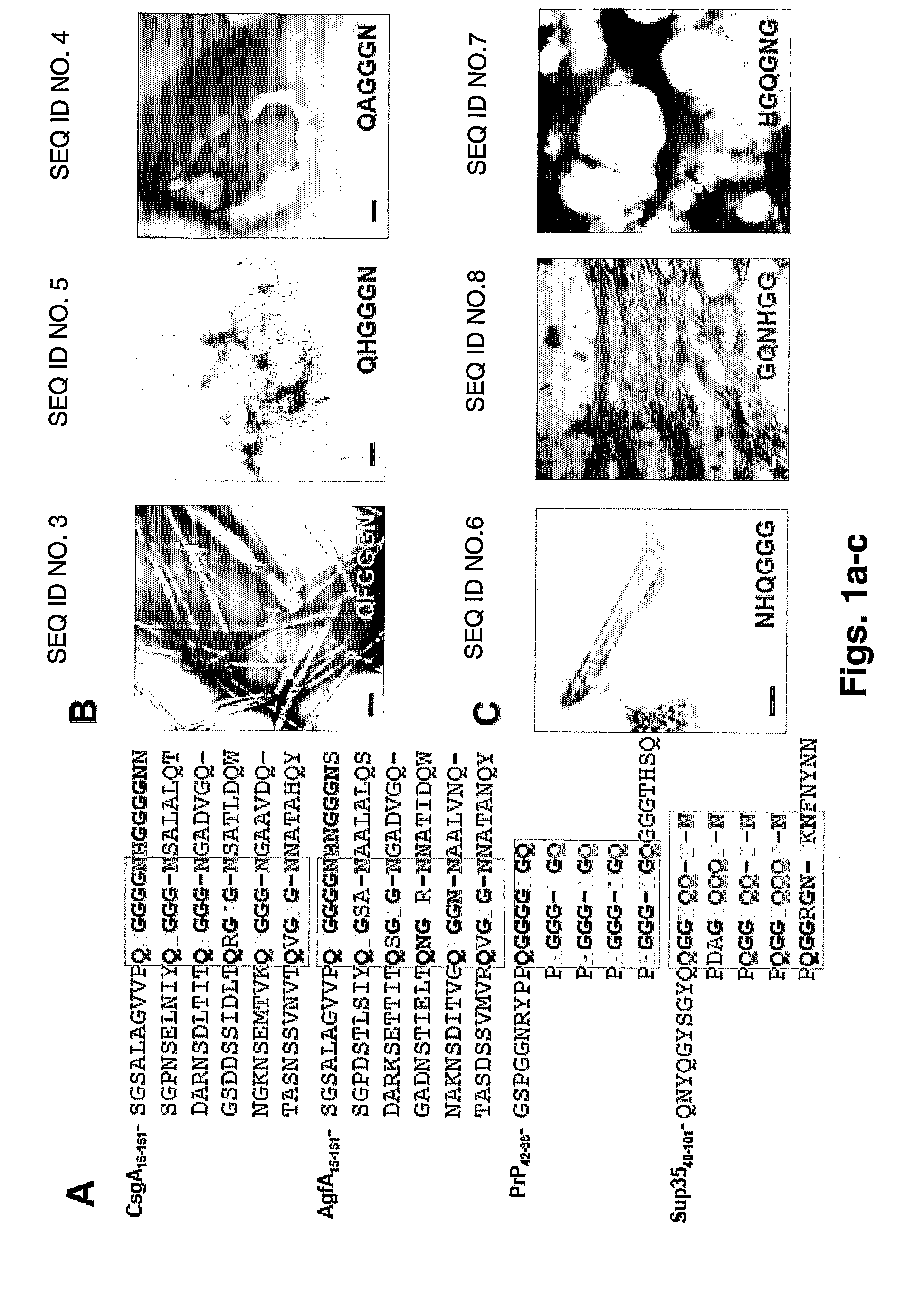 Use of anti-amyloid agents for treating and typing pathogen infections