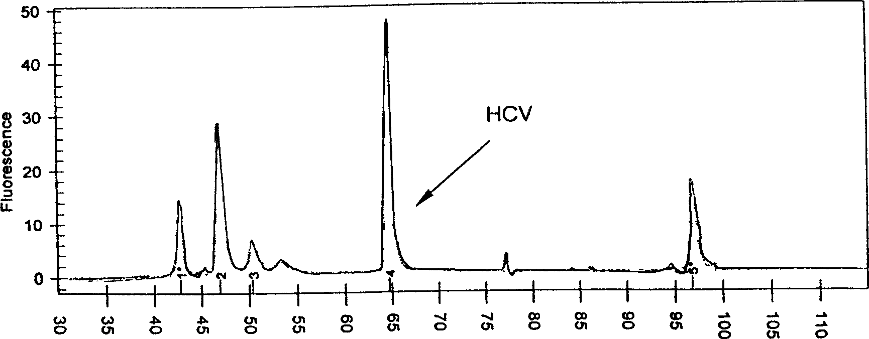 Process for simultaneously carrying out RNA and DNA extraction from clinical samples by employing virus cracking liquid and precipitation process