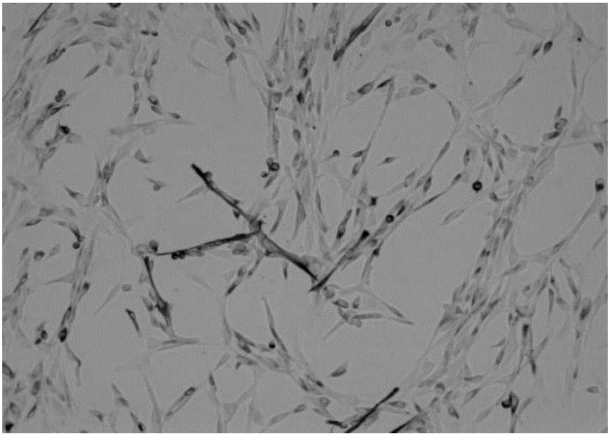 Skeletal muscle stem cell serum-free medium and preparation method and application thereof