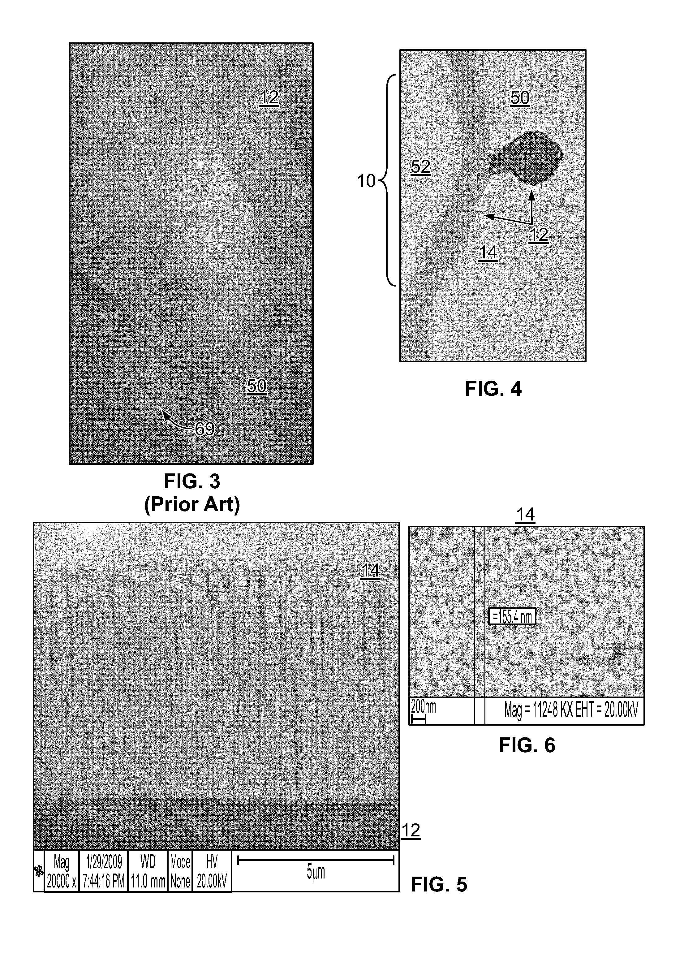 Systems and devices for cerebral aneurysm repair