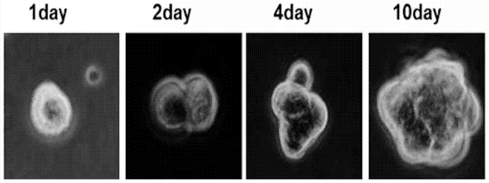 A kind of separation, culture method and application of testicular mesenchymal stem cells