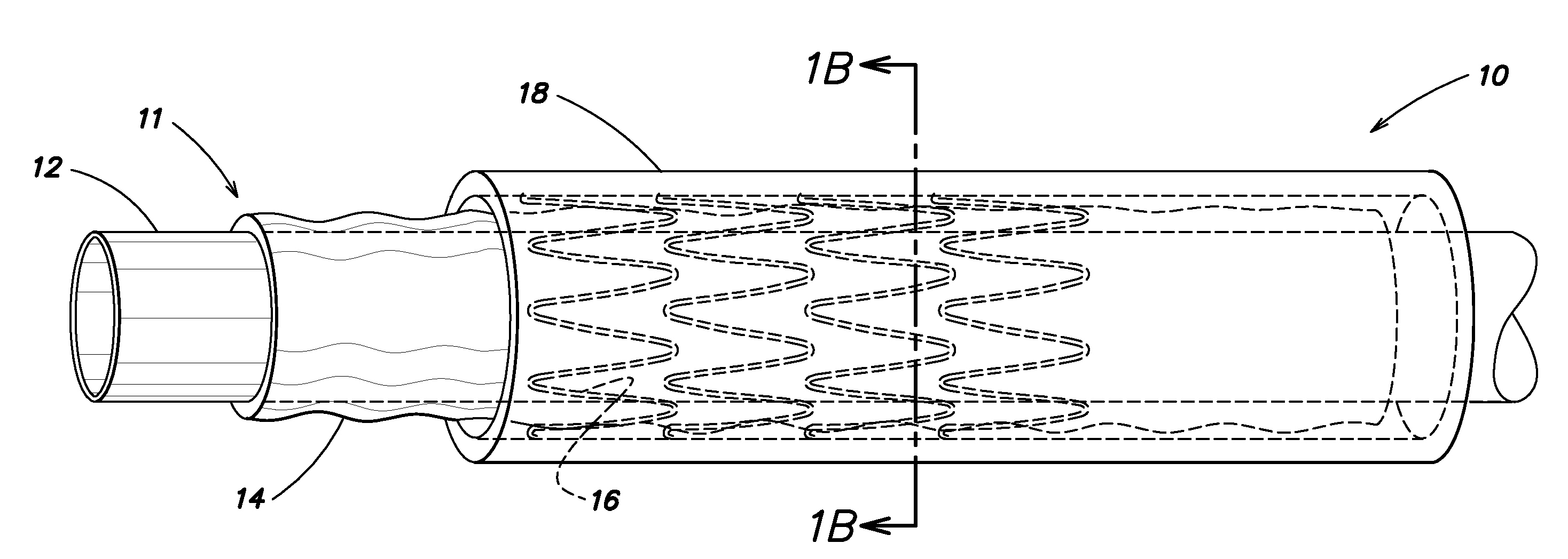 Device delivery system with balloon-relative sheath positioning