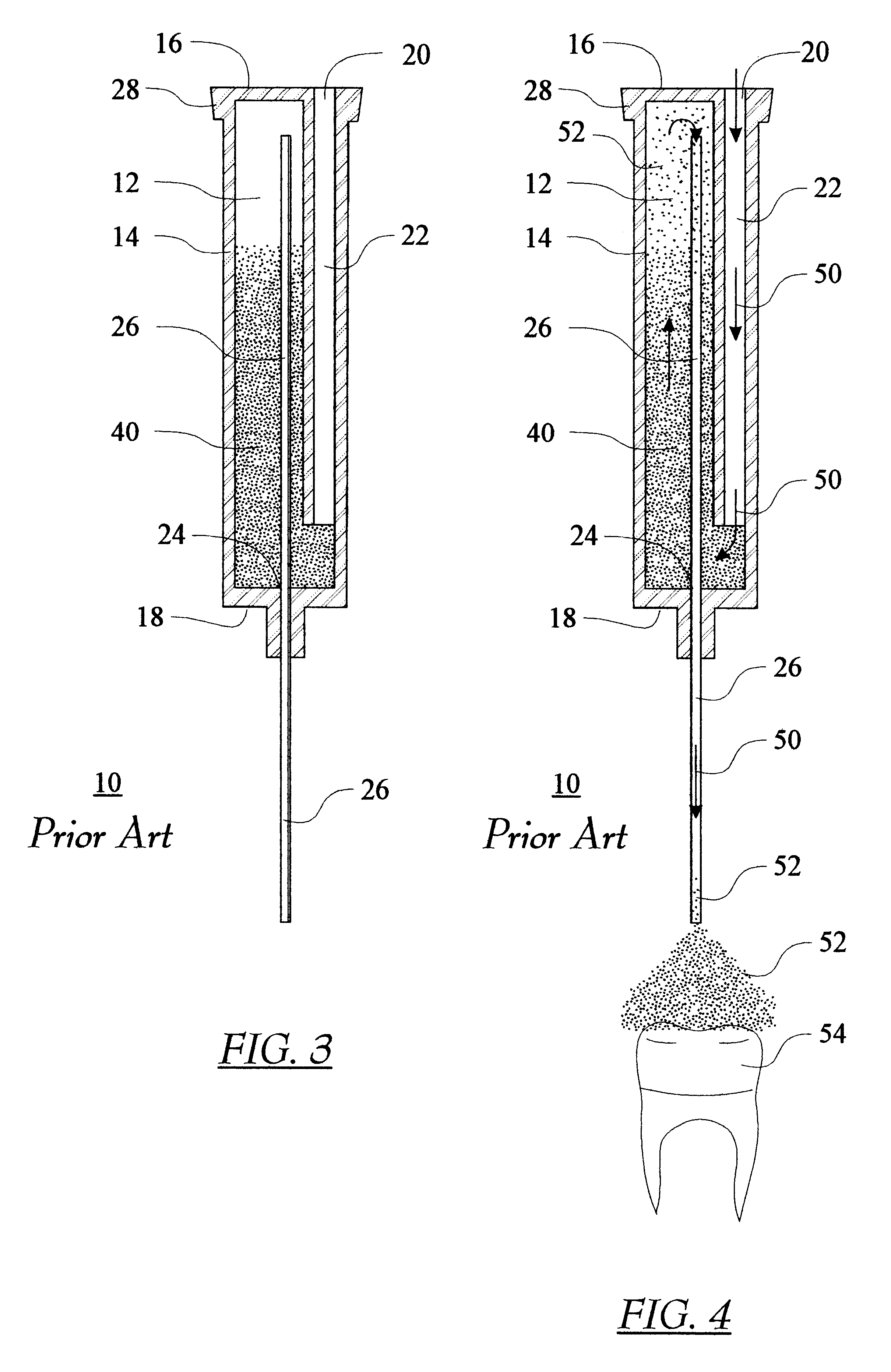 Disposable, multi-conduit particulate matter propelling apparatus