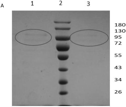 Hexosaminidase and coding gene related to strawberry softening, preparation and application thereof