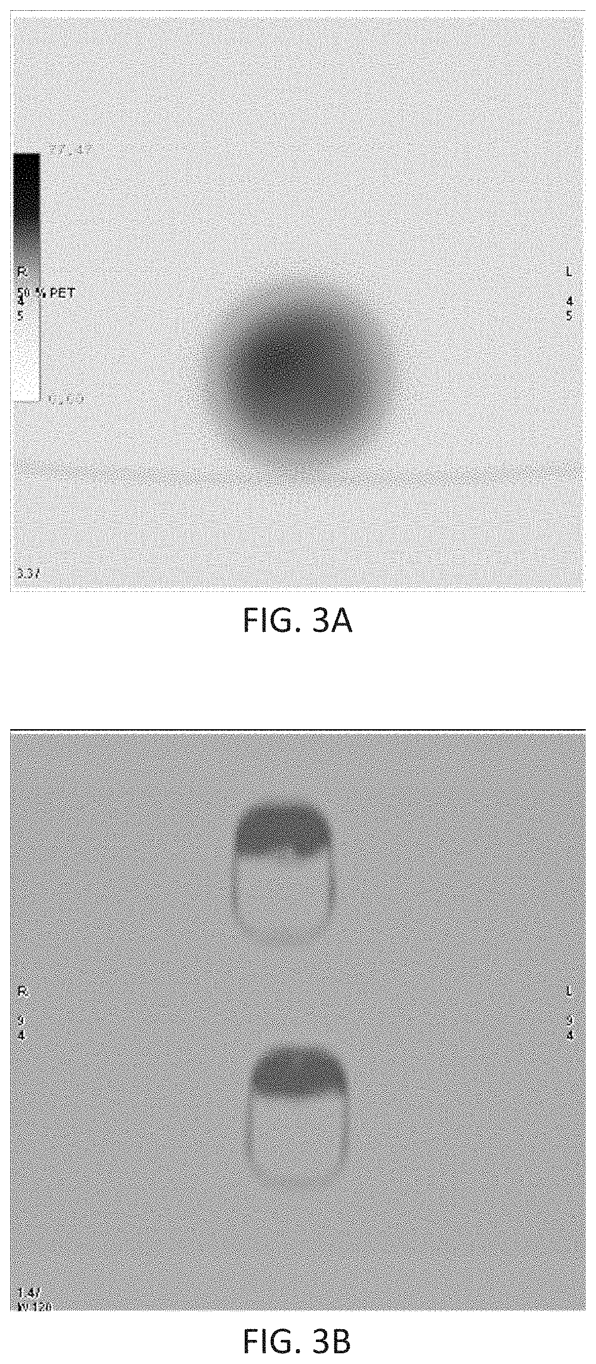 Compositions, devices and kits for selective internal radiation therapy