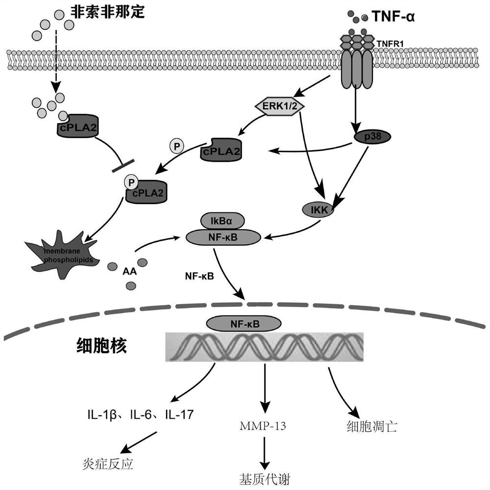 Application of fexofenadine in preparation of medicine for preventing and treating intervertebral disc degeneration