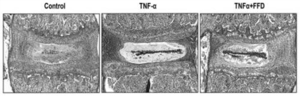 Application of fexofenadine in preparation of medicine for preventing and treating intervertebral disc degeneration