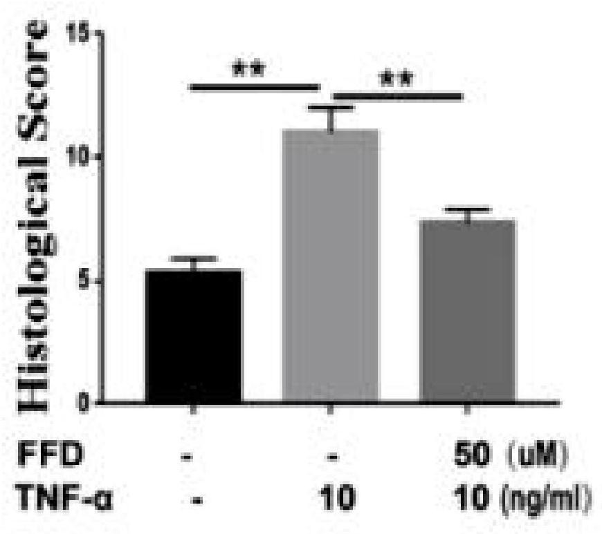 Application of fexofenadine in preparation of medicine for preventing and treating intervertebral disc degeneration