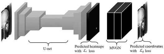 Method, device and application of medical key point detection based on multi-scale topology map