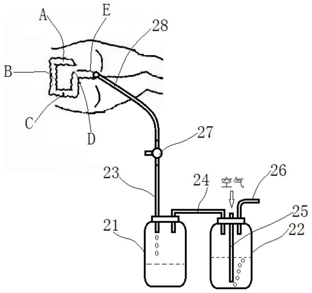 Auxiliary device used for anal tube gas exhaust