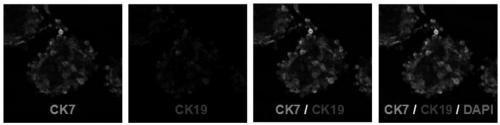 Method for stem cell differentiating mesenchymal stem cells into bile duct cells