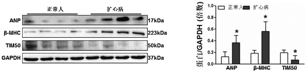 Application of inner mitochondrial membrane transport protein 50 (TIM50) in treating myocardial hypertrophy