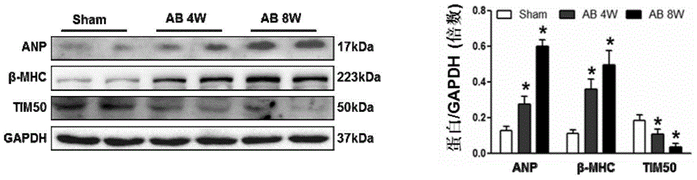 Application of inner mitochondrial membrane transport protein 50 (TIM50) in treating myocardial hypertrophy