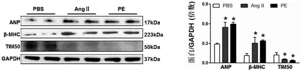 Application of inner mitochondrial membrane transport protein 50 (TIM50) in treating myocardial hypertrophy