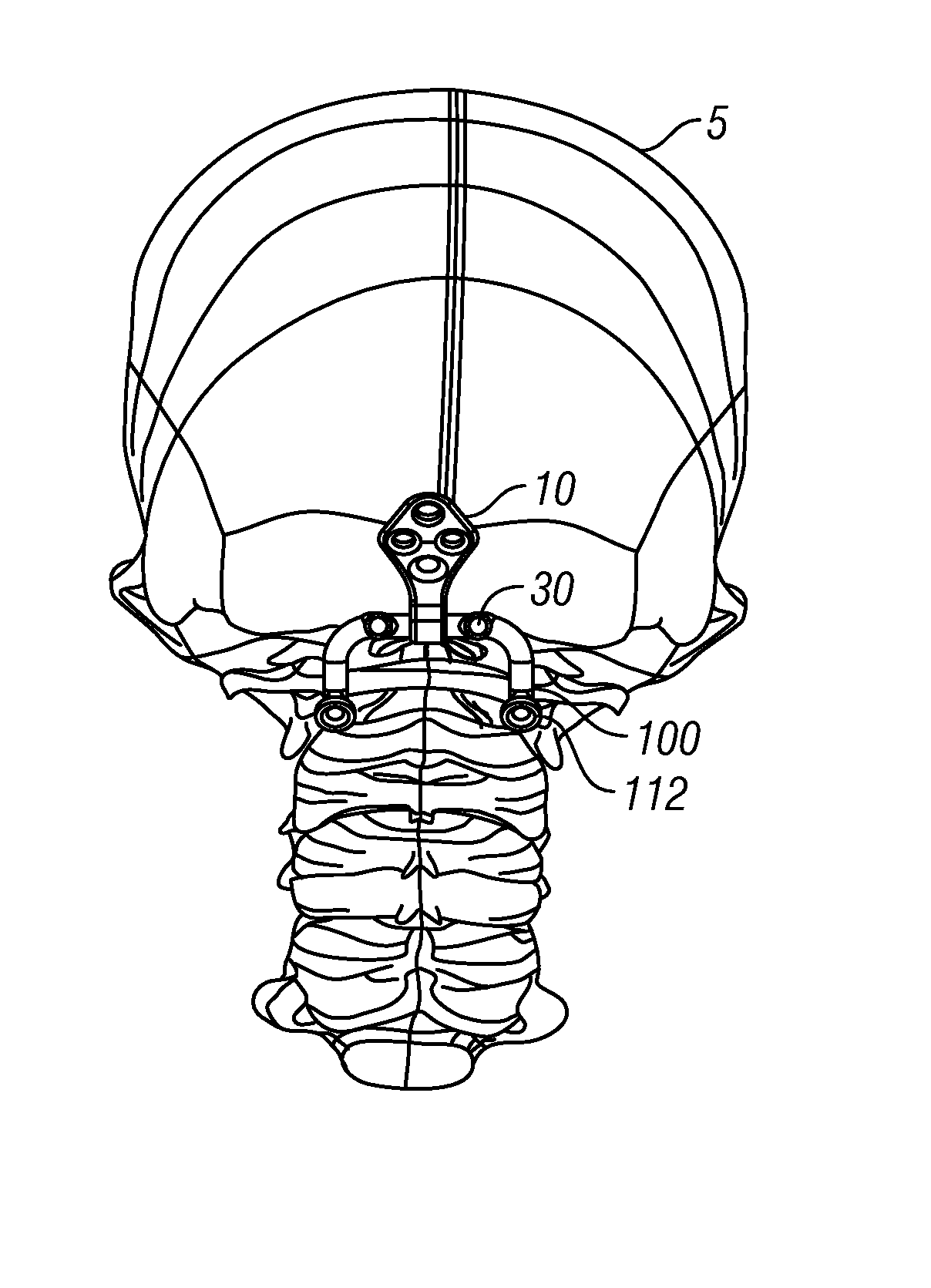 Occipital plate systems