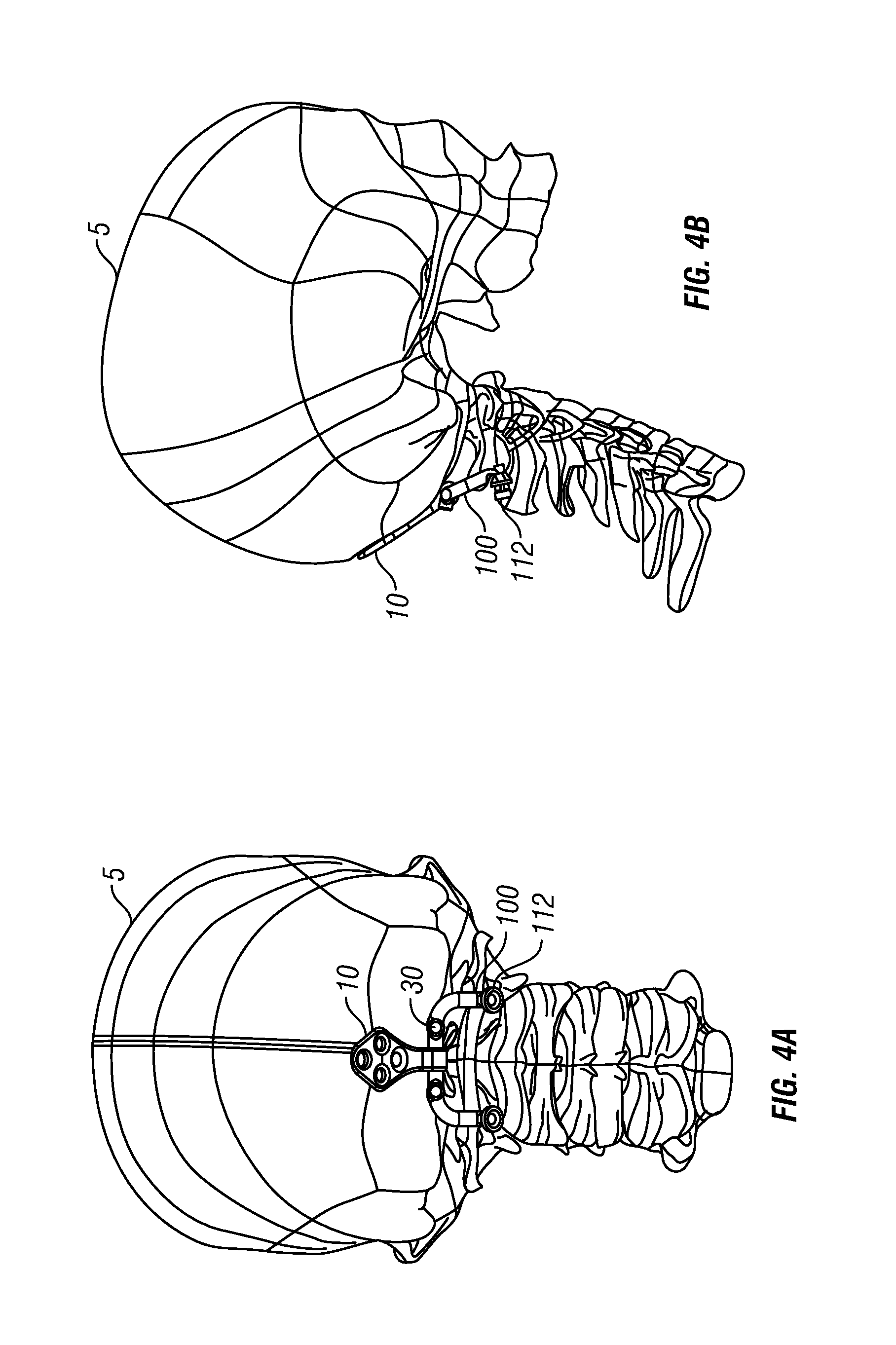 Occipital plate systems