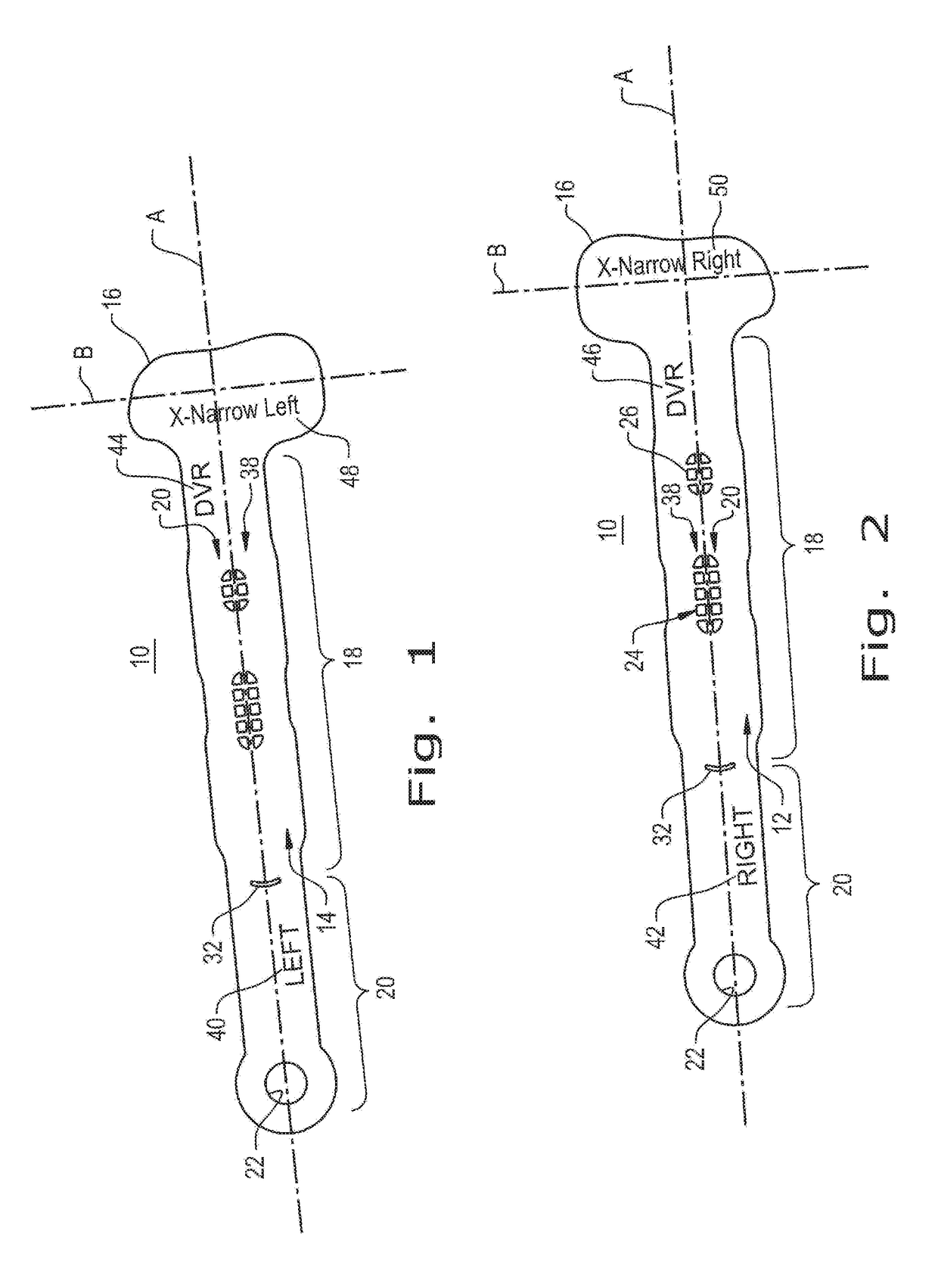 Orthopaedic implant template and method of making