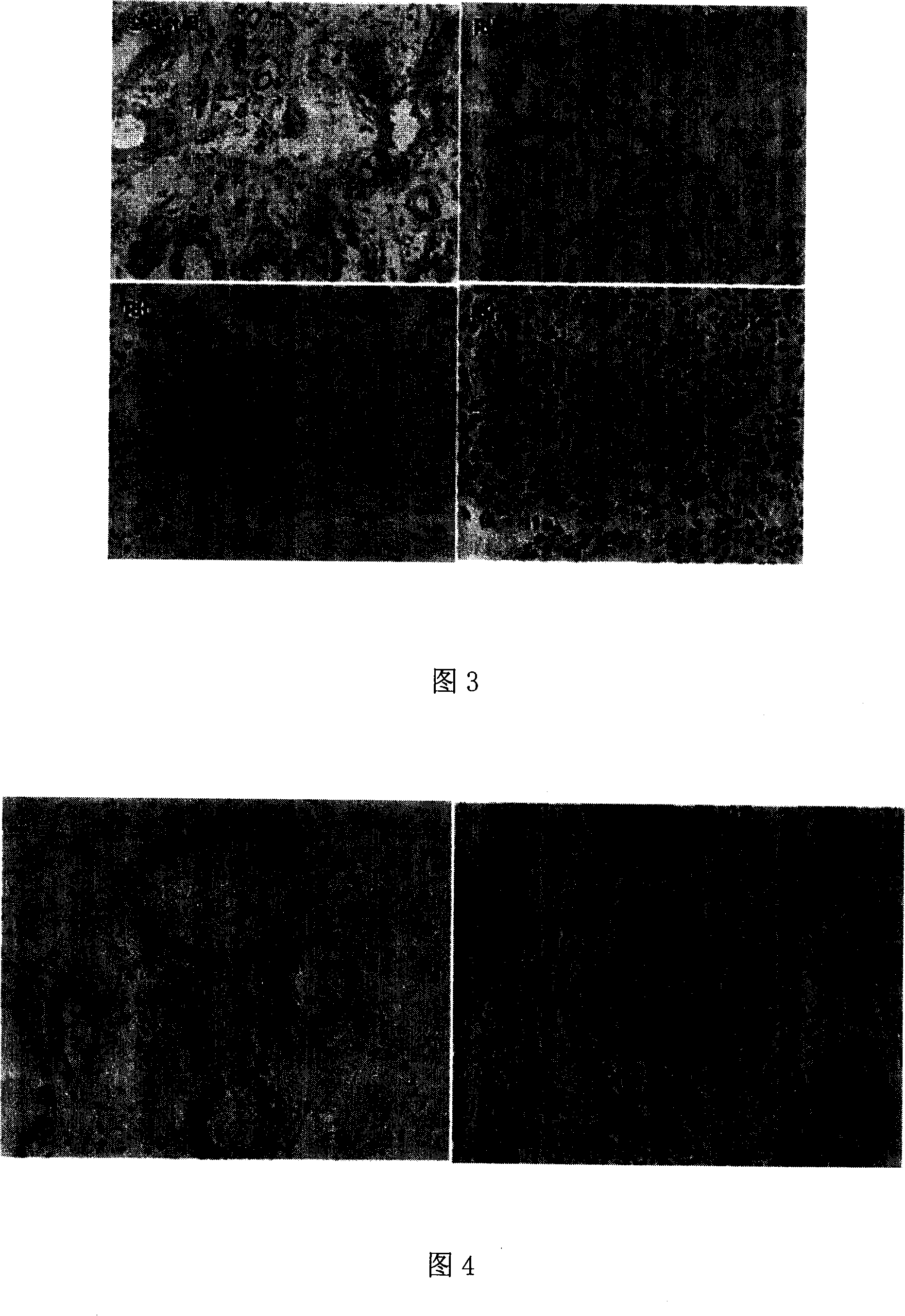 Nucleic acid aptamer with high specificity and high affinity to human breast carcinoma tissue, preparation method and application thereof