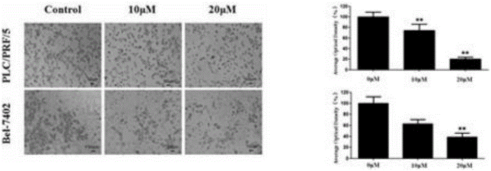 Applications of apigenin for preparation of medicines inhibiting liver cancer epithelial-mesenchymal transition