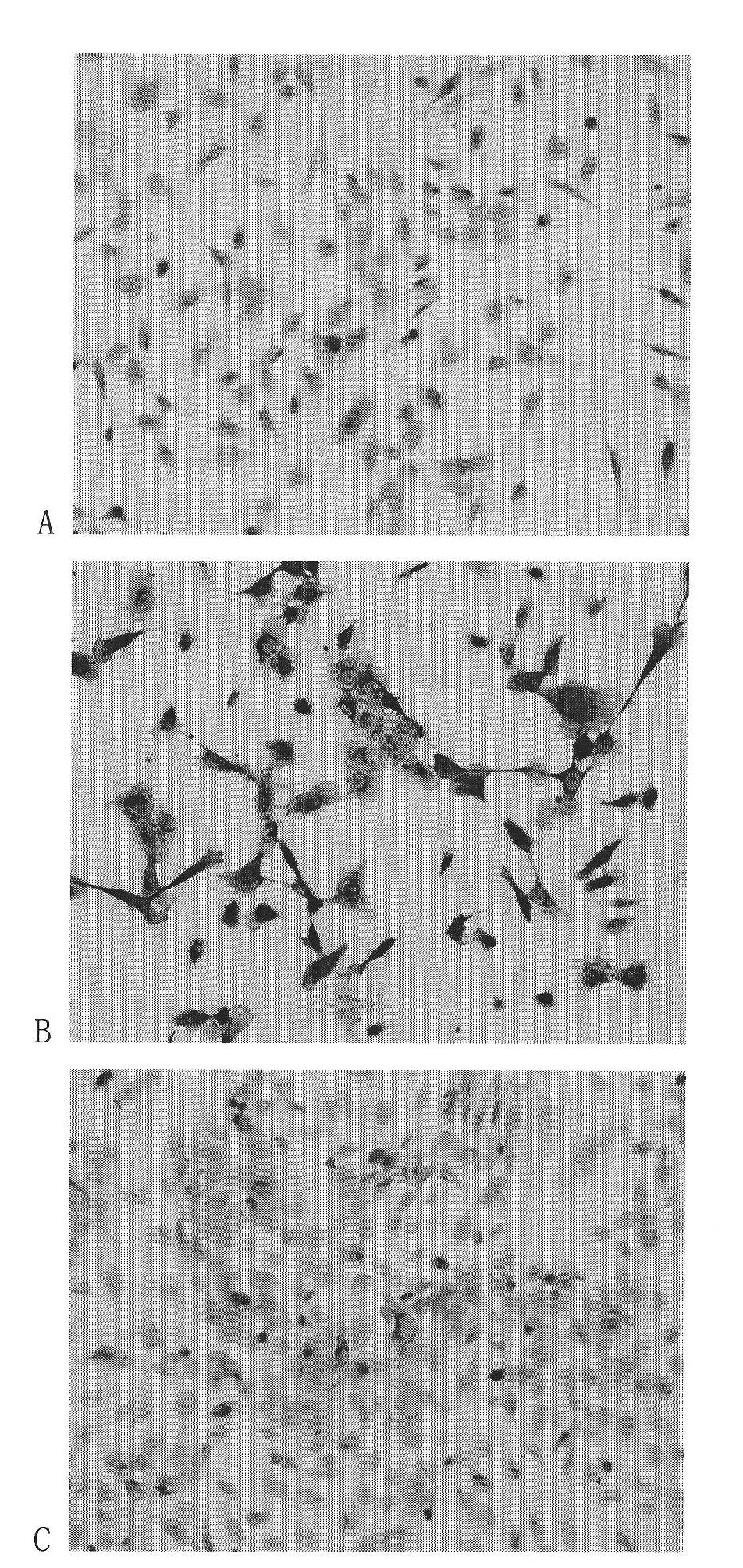 Human pancreatic cancer cell line and its application