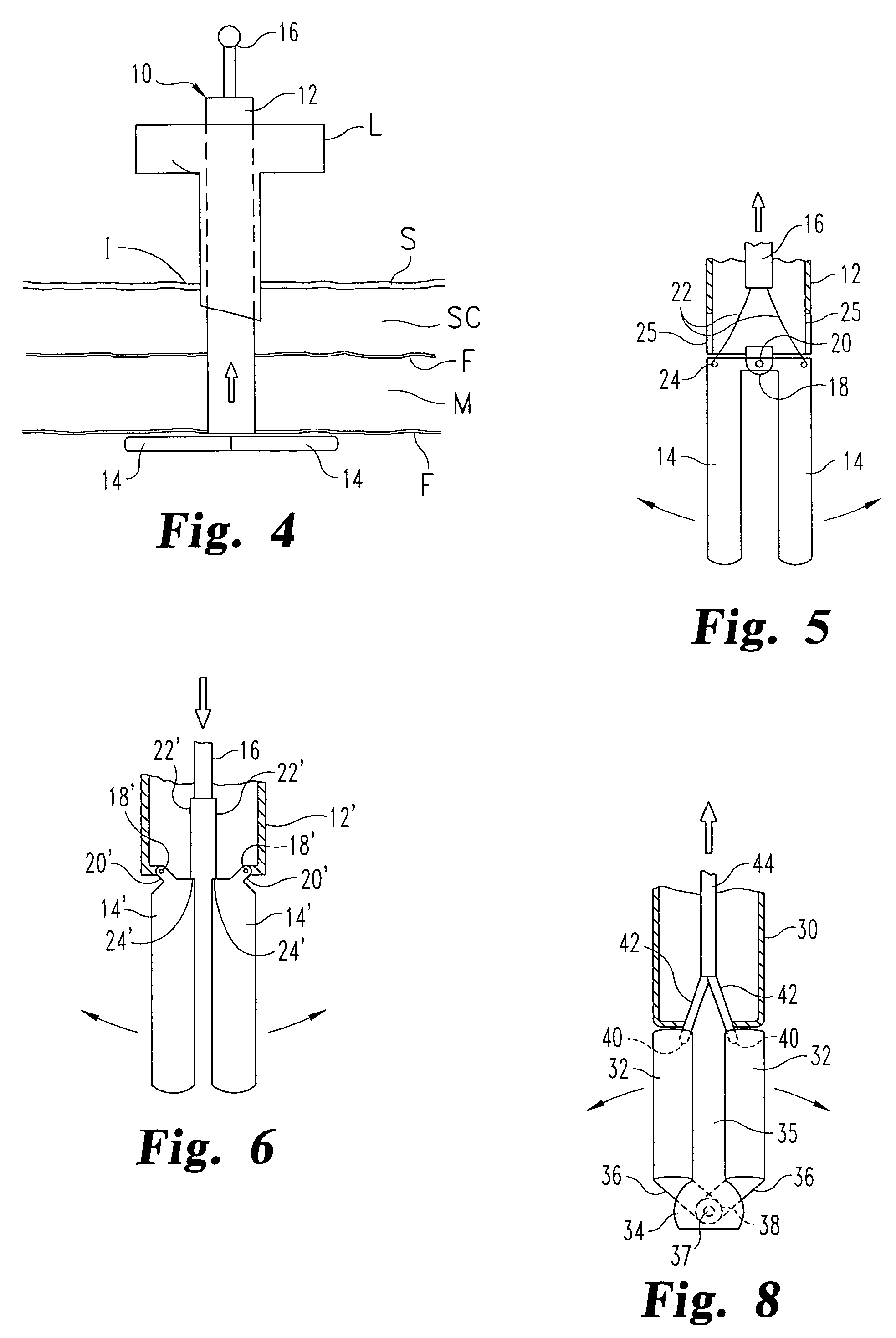 Laparoscopic port site closure tool