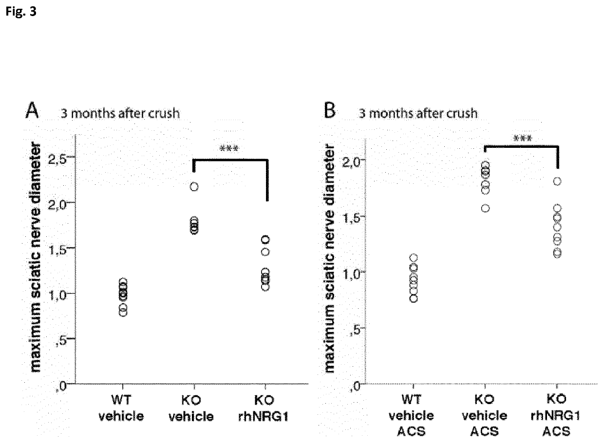 Neuregulin for the treatment and/or prevention of tumors of the nervous system