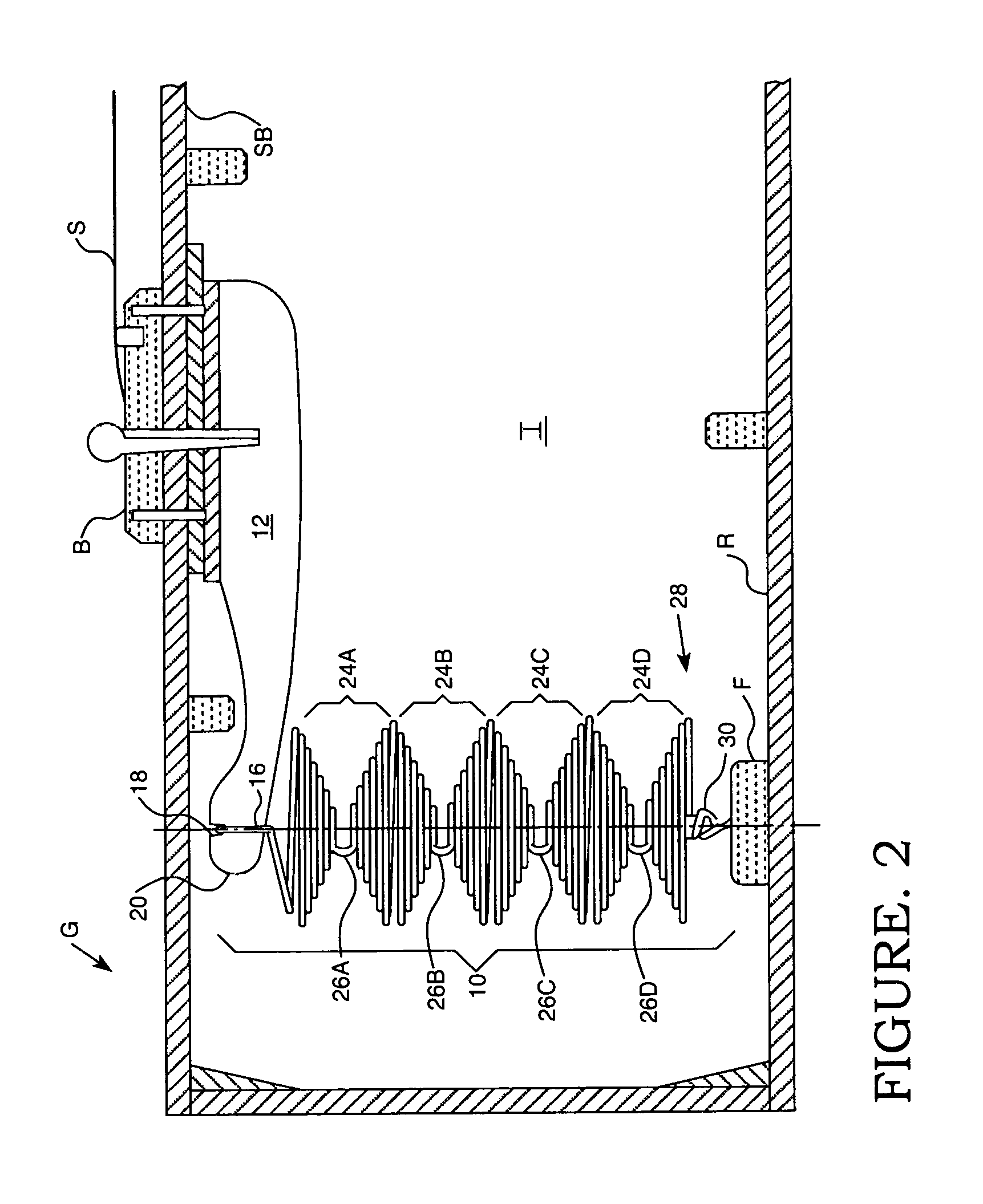 Organic sound texture enhancement and bridge strengthening system for acoustic guitars and other stringed instruments