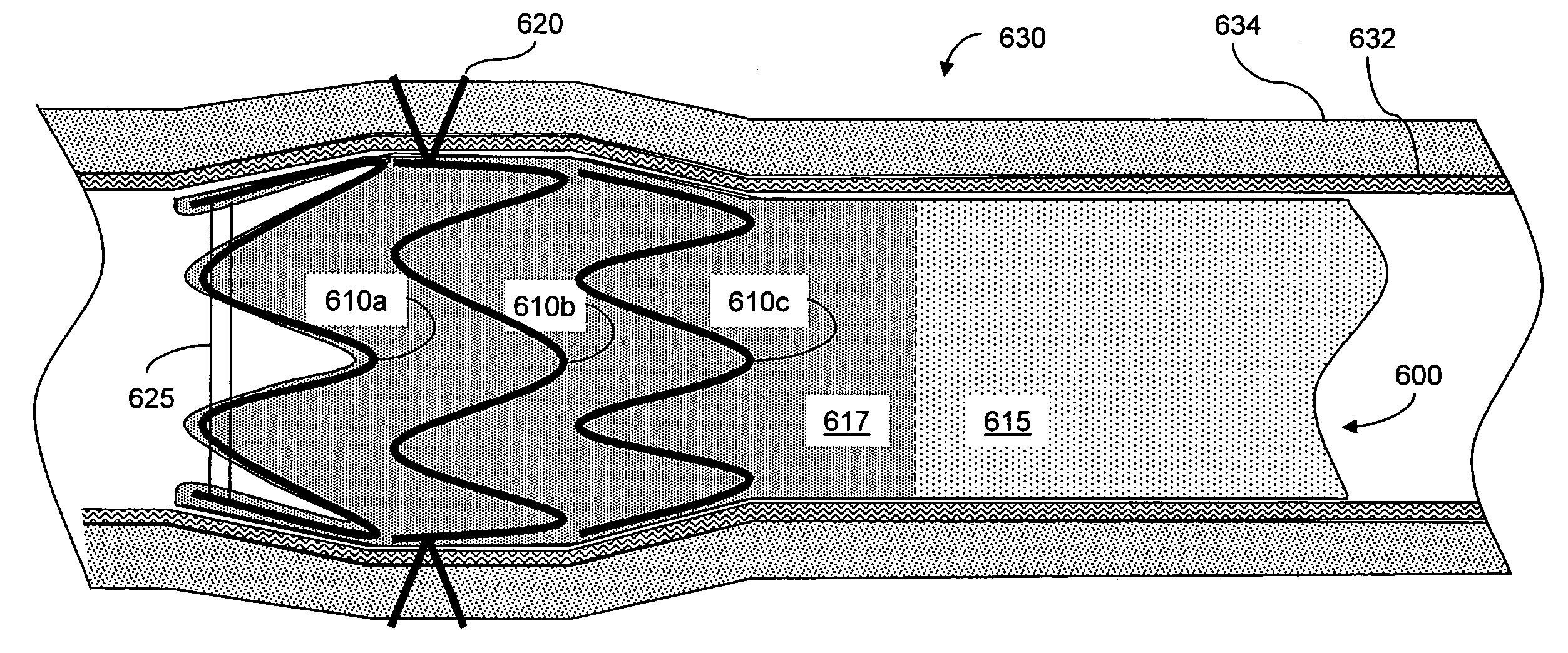 Atraumatic gastrointestinal anchor