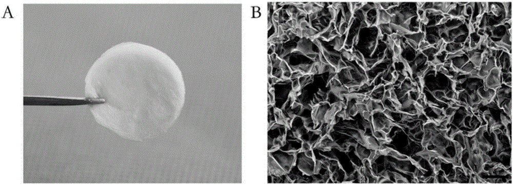 Epidermal graft as well as preparation method and application thereof