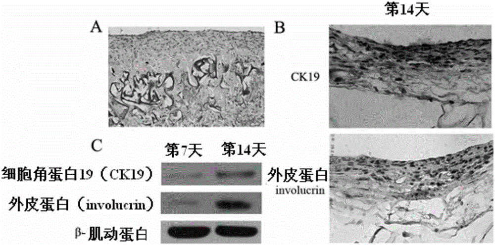 Epidermal graft as well as preparation method and application thereof