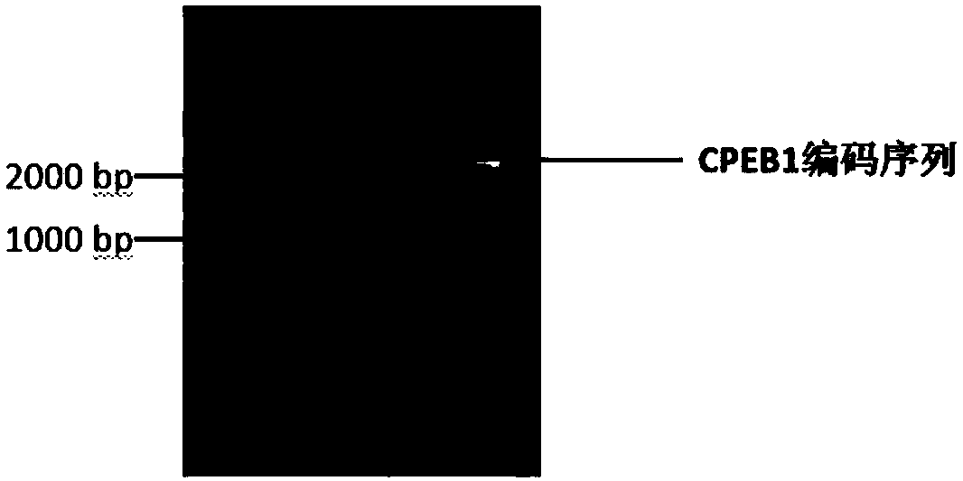 Lentiviral vector containing CPEB1 gene negative regulation region as well as preparation method and applications of lentiviral vector