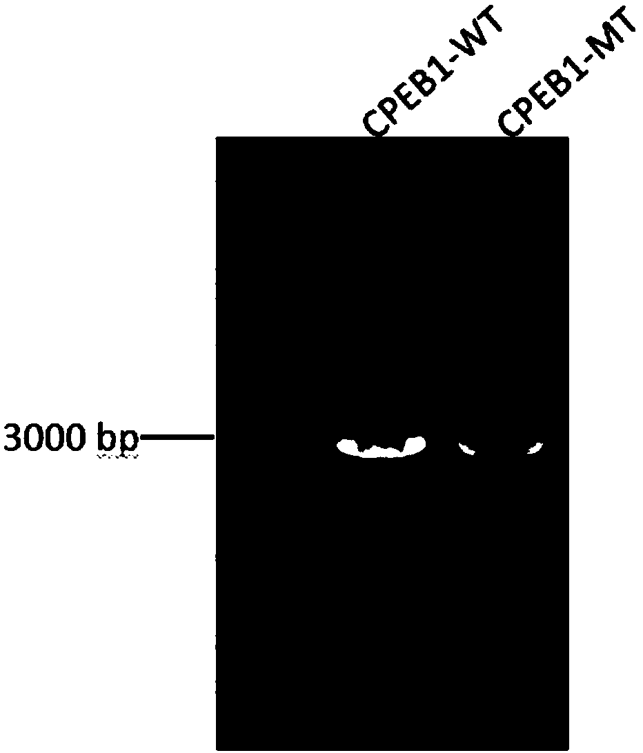 Lentiviral vector containing CPEB1 gene negative regulation region as well as preparation method and applications of lentiviral vector