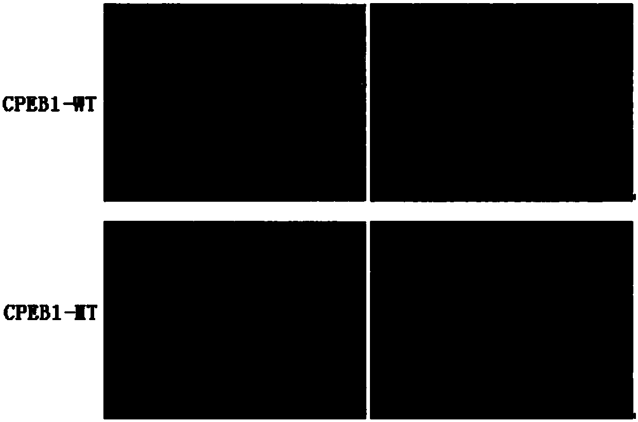 Lentiviral vector containing CPEB1 gene negative regulation region as well as preparation method and applications of lentiviral vector