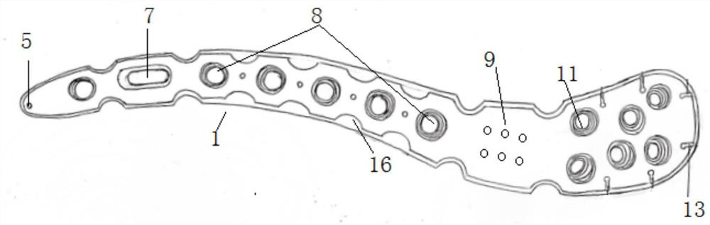 Clavicle far-end bone fracture plate with coracoclavicular ligament reconstruction hole