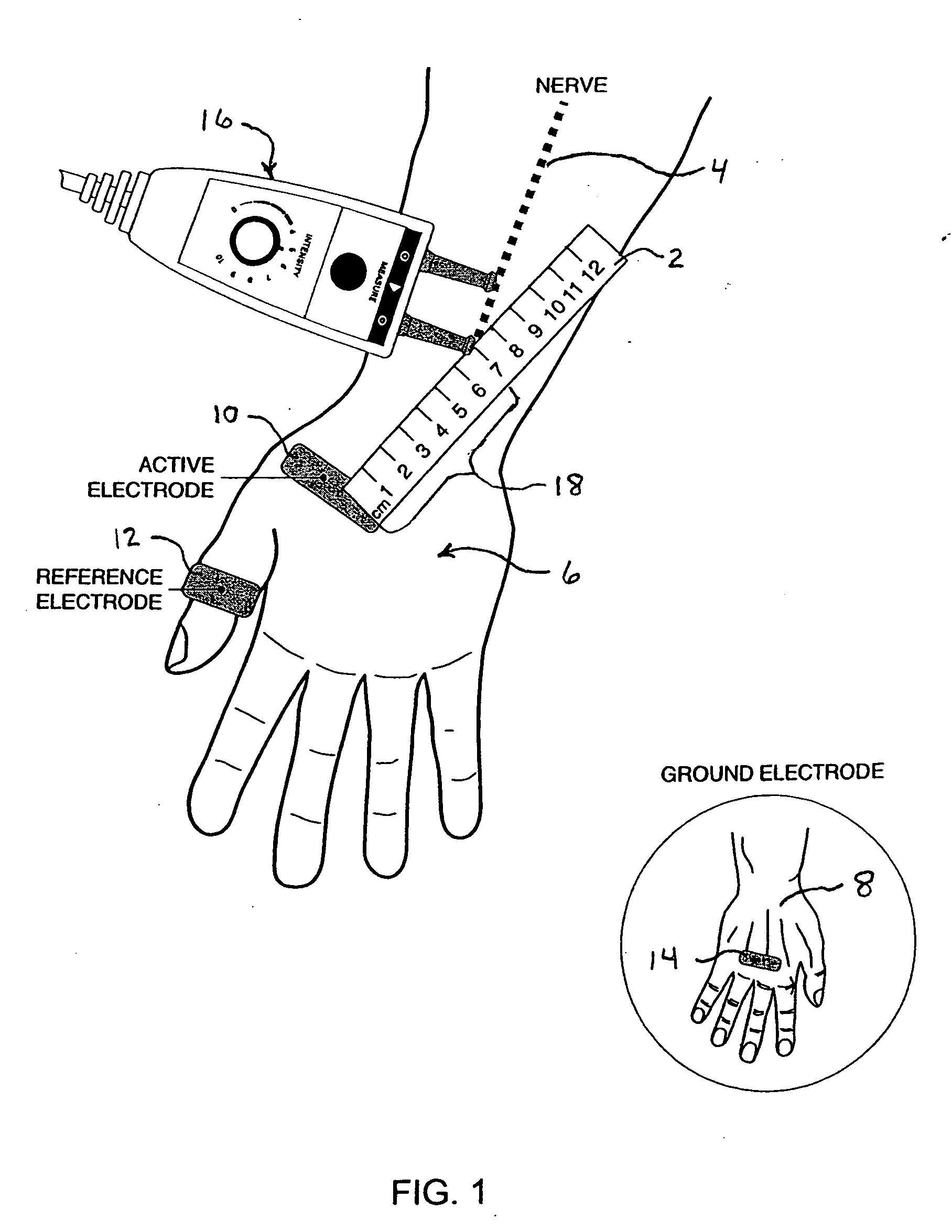 Apparatus for neuromuscular function signal acquisition