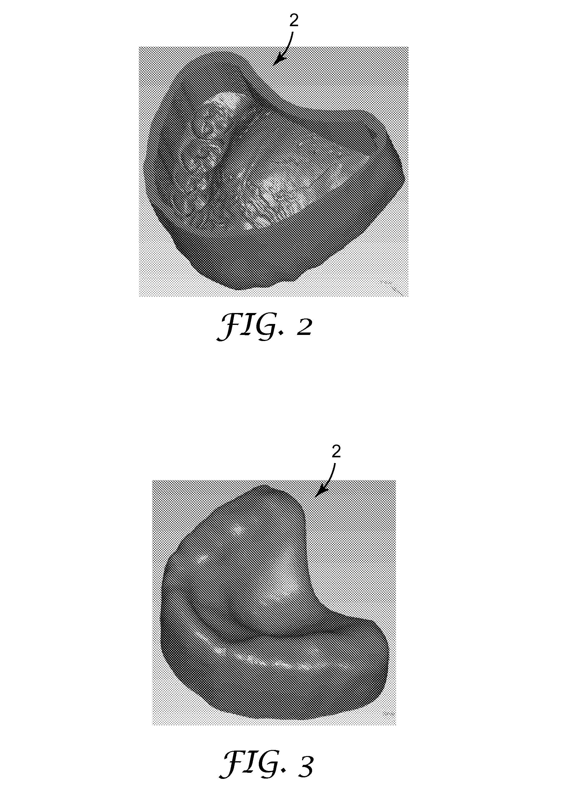 Digitally forming a dental model for fabricating orthodontic laboratory appliances