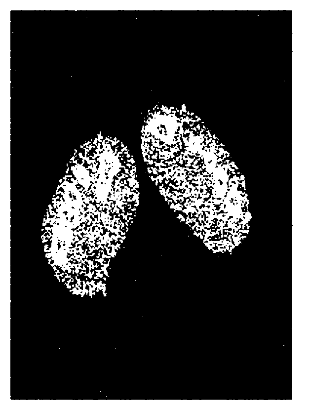 Image de-noising method based on sparse self-adapted dictionary