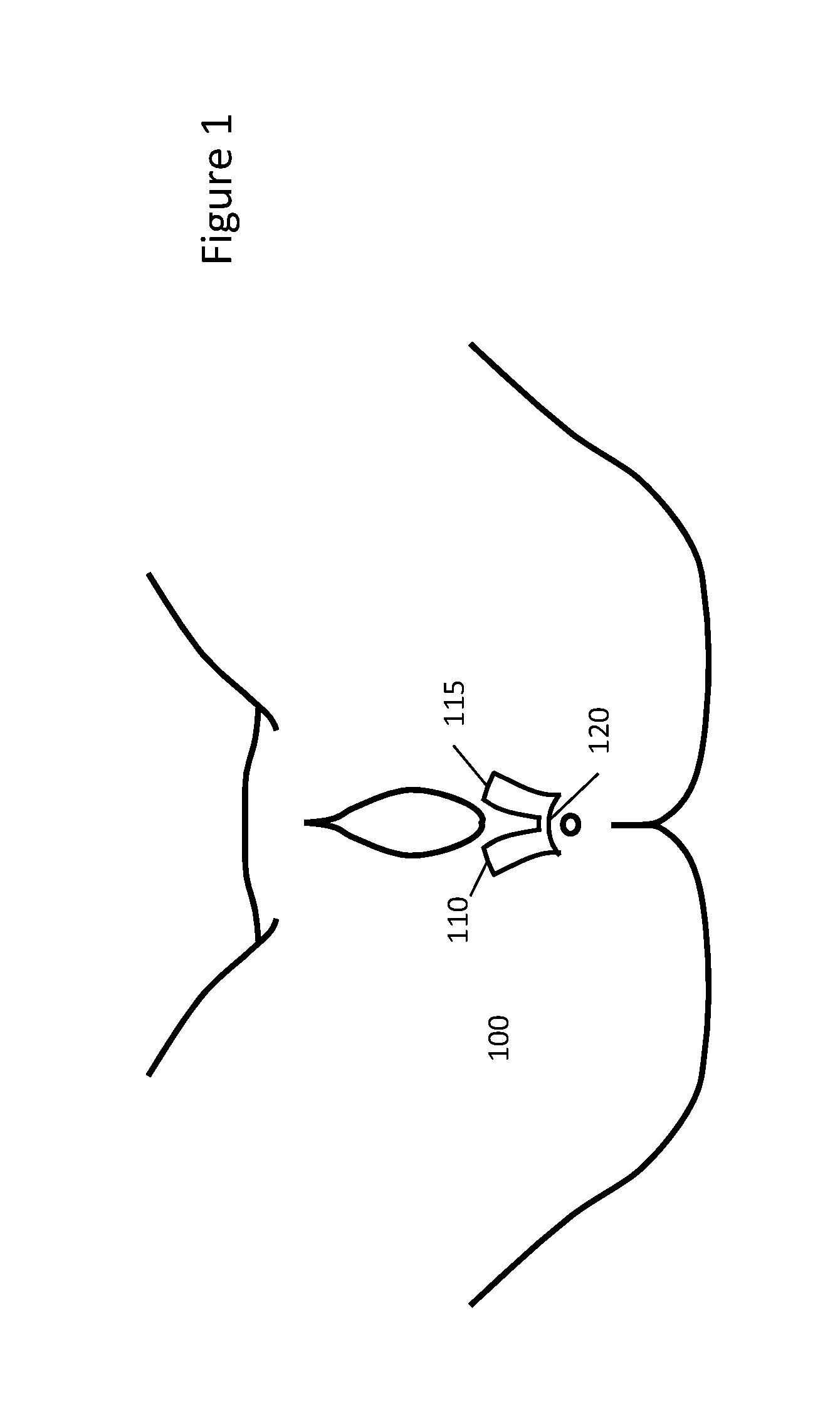 Device and Methods to Reduce Vaginal Tearing During Delivery