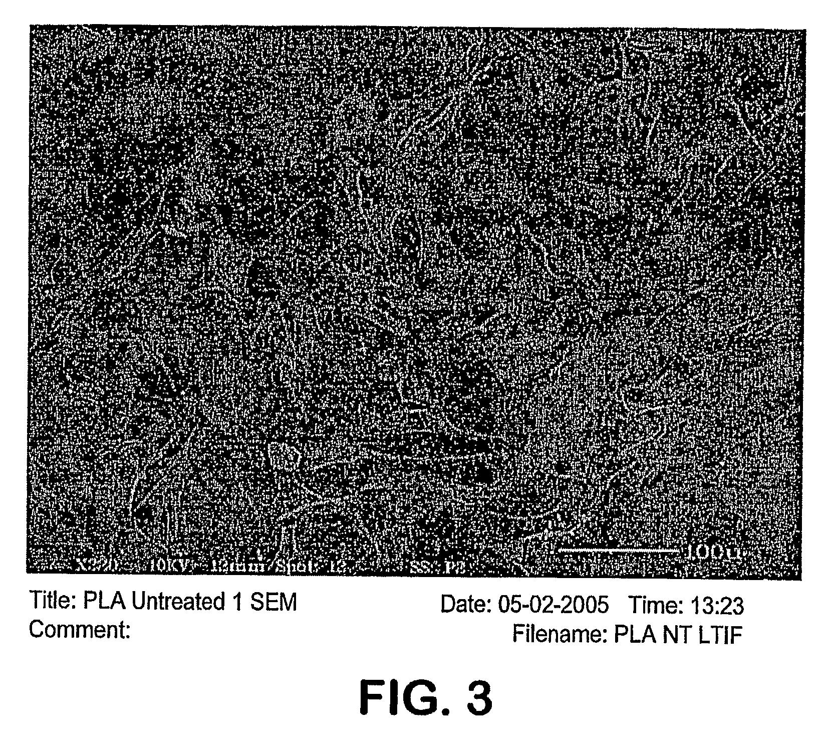 Bioresorbable composition for repairing skeletal tissue