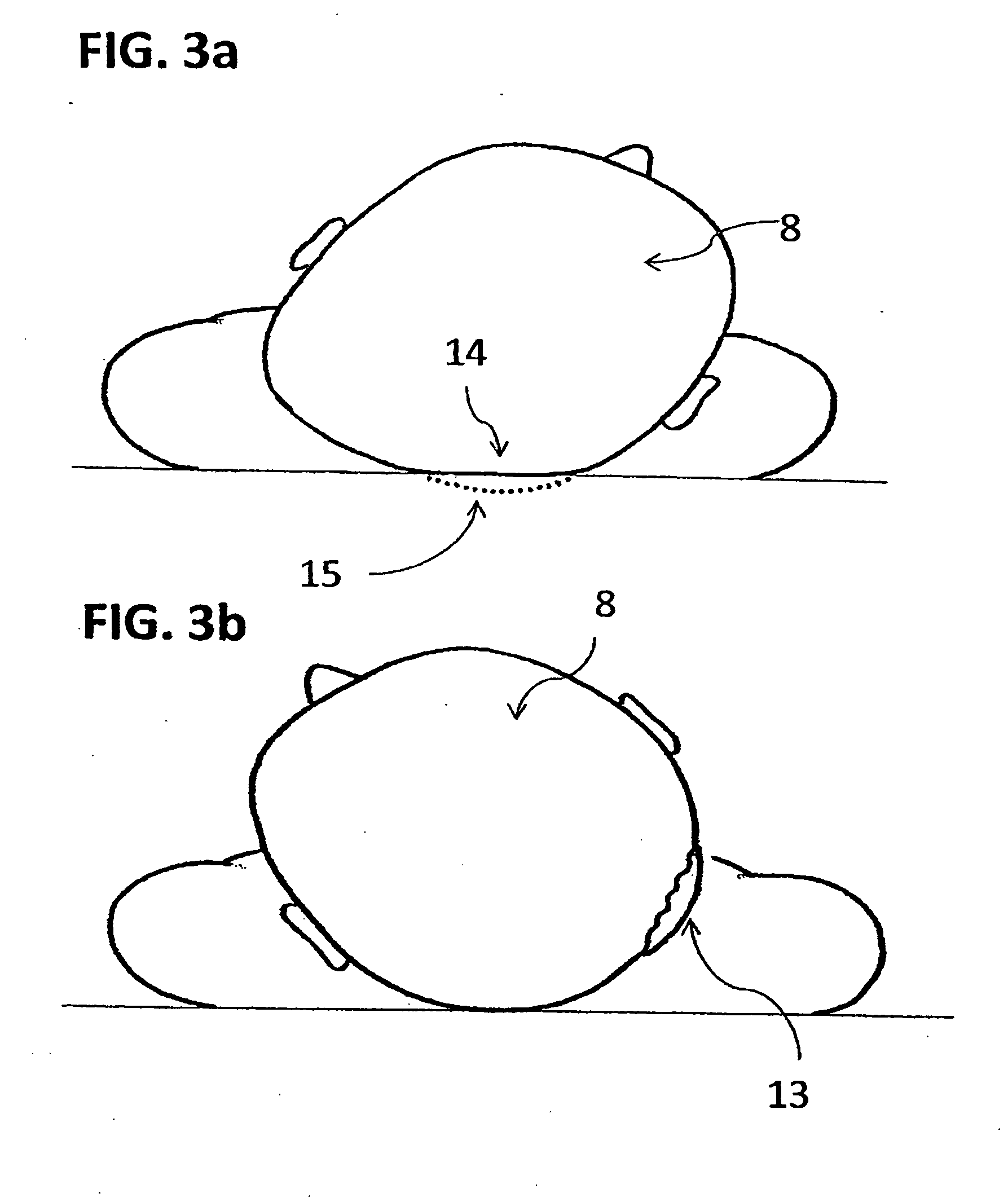 Infant headwear for treating an infant's persistently maintained head position, seen in conditions such as plagiocephaly (baby flat head) and torticollis (wry neck)