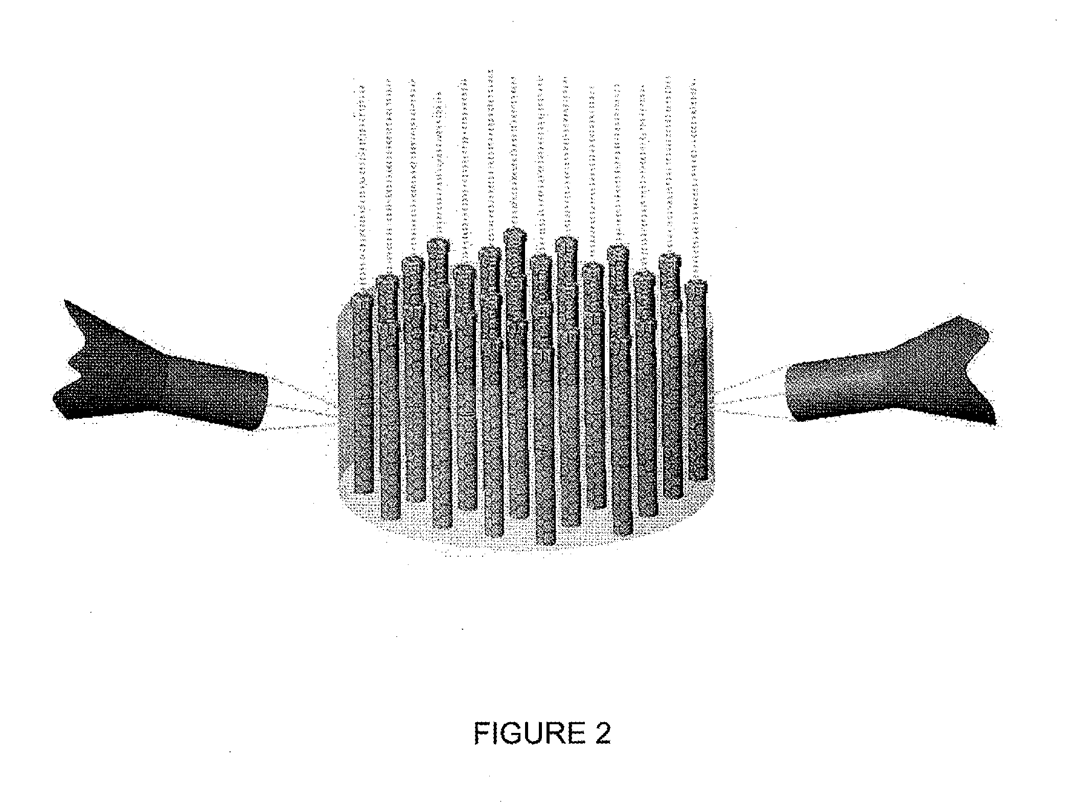 Ultraconducting articles