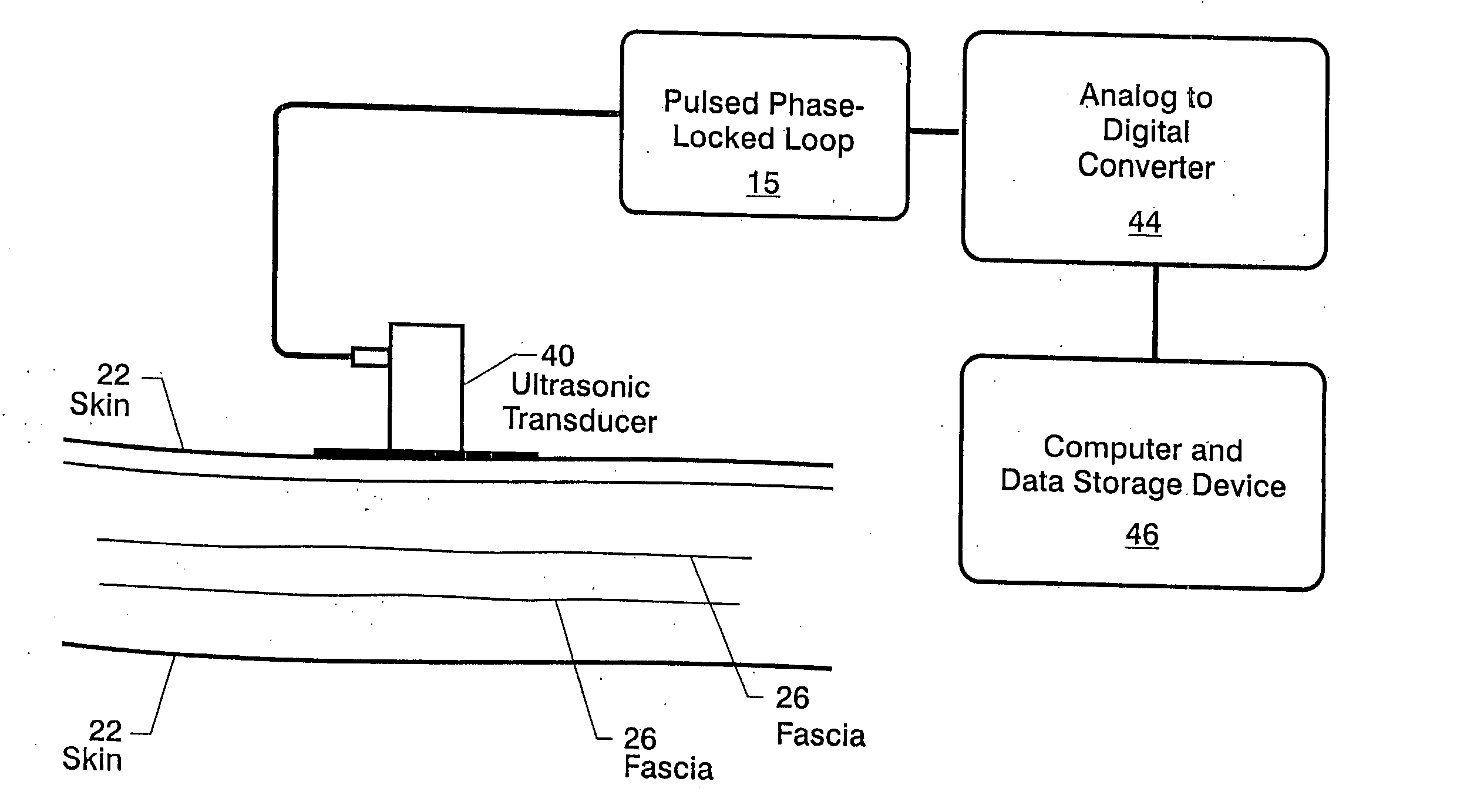 Method and apparatus to assess compartment syndrome