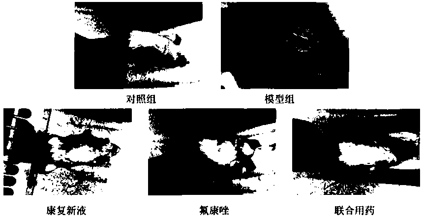 Antifungal pharmaceutical composition consisting of periplaneta americana extract and antifungal drug